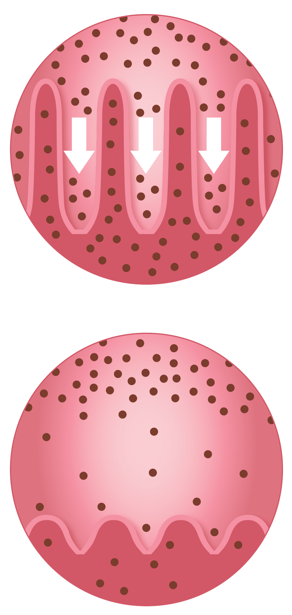 Coeliac Disease (no labels) Guts UK