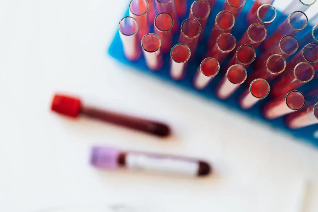 Blood test tubes in a test tube holder. Two are laying down on the table separately, filled with blood samples and have lids on them.