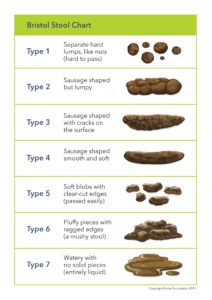 Bristol Stool Chart 212x300 