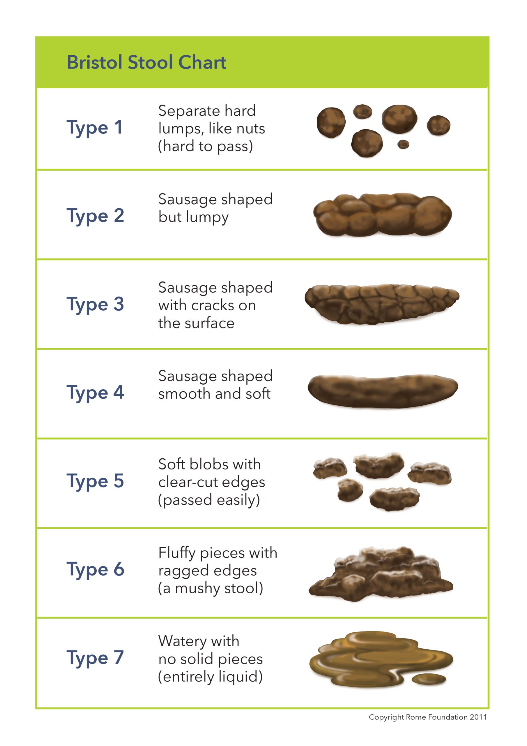 Types of constipation