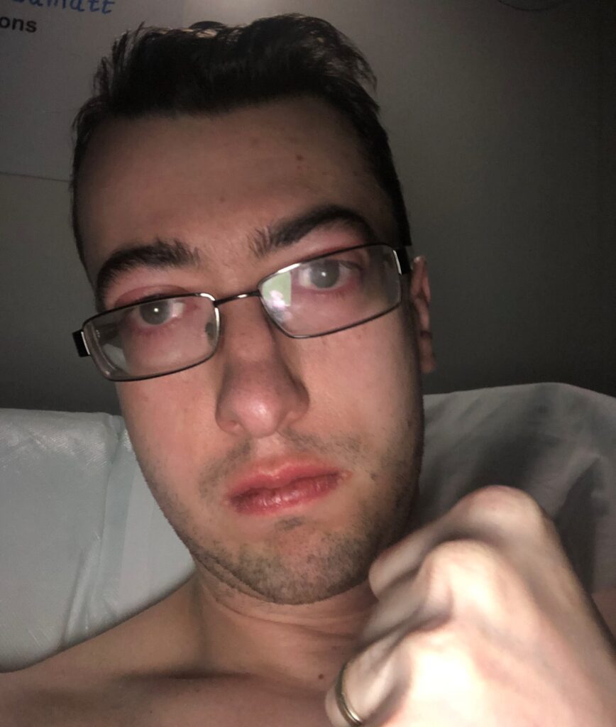 Matthew is taking a selfie, from his chest upwards and is holding his fist up in strength at the camera. He is in a hospital bed and wears black rimmed curved, rectangular glasses.