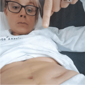 Rachel is laid down in her white long sleeved t shirt pulled up to her ribcage to display her stomach. She is starting at her stomach and pointing with her left index finger to show that her stoma has been reversed.