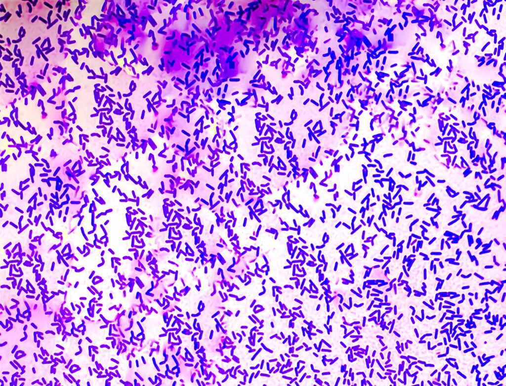 Lactobacillus bacteria under a microscope on white background.