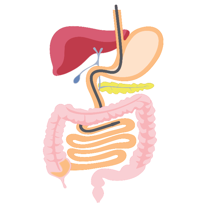 A diagram showing an endoscopy (tube down the throat) to look into the digestive tract.