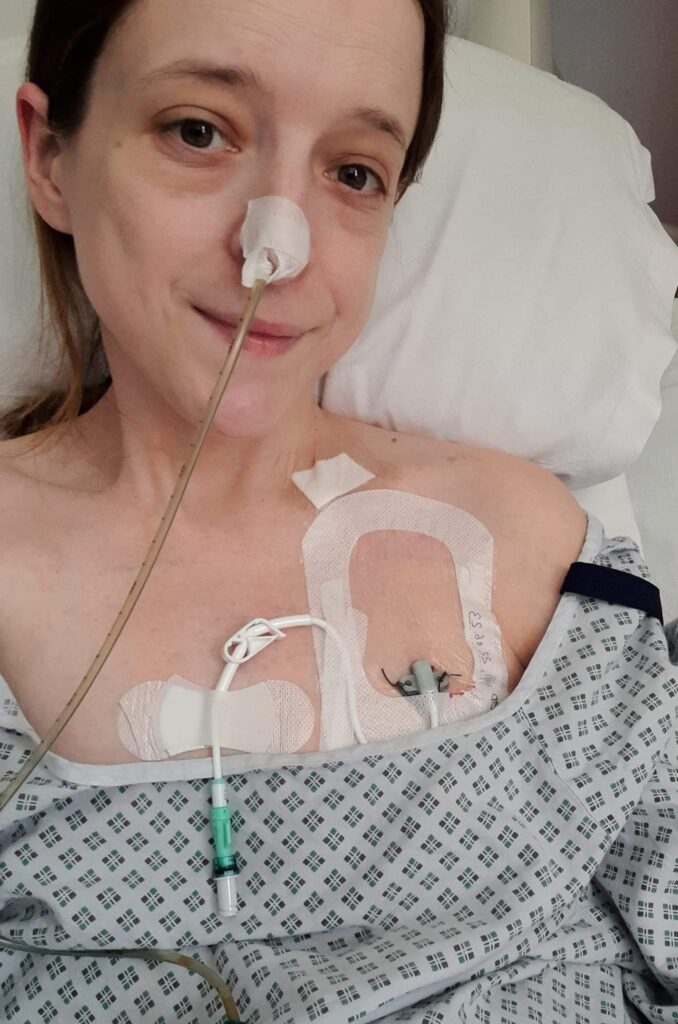 A selfie of Lisa in hospital, showing her Hickman line and NG tube.