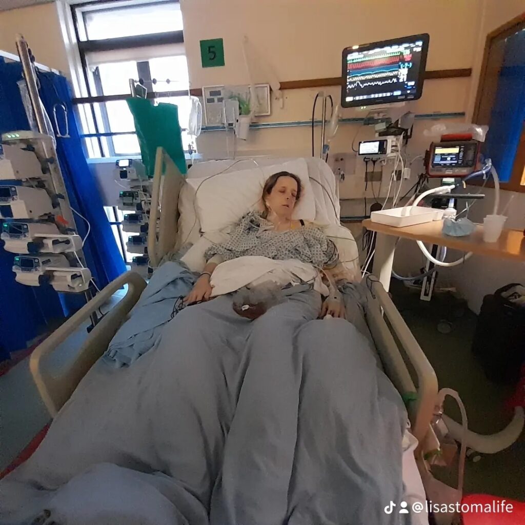 Lisa is in the Intensive Care Unit, surrounding by various hospital machines and wires. She wears a hospital gown and is covered with a light blue hospital blanket.